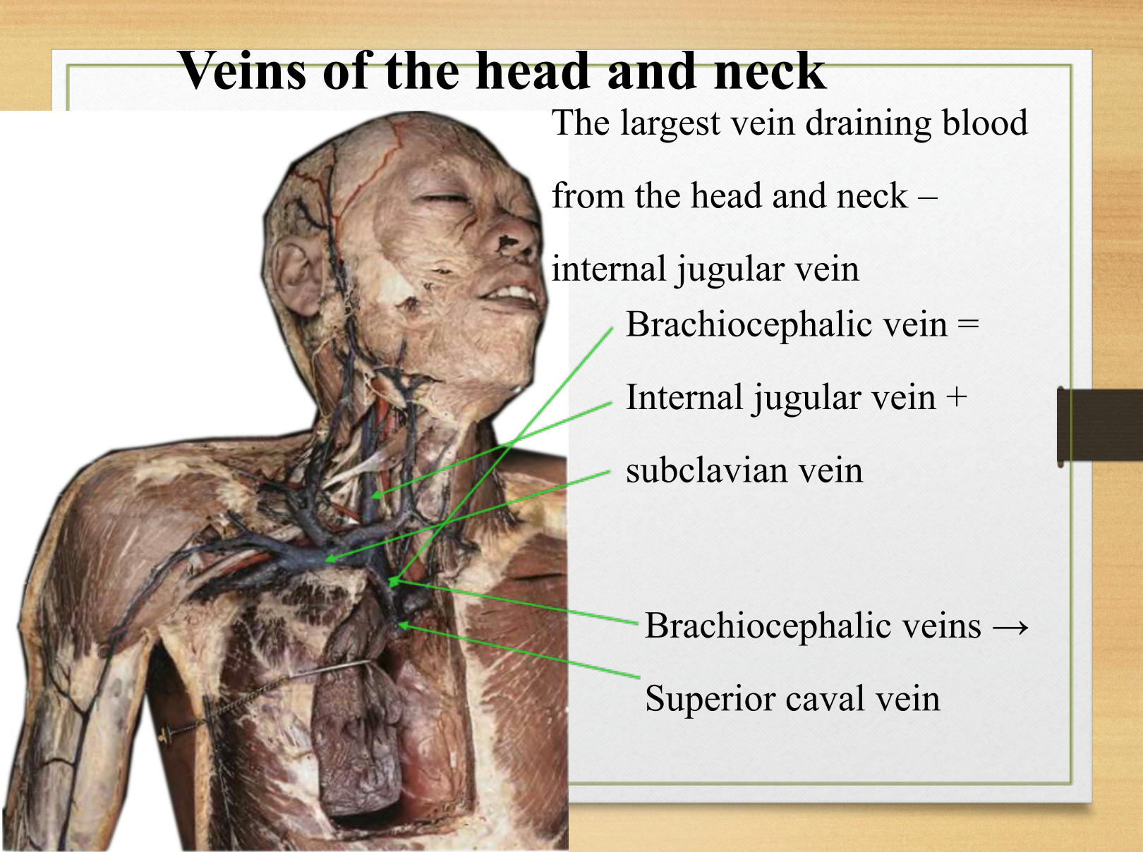 abbi graham recommends kneck or neck pic