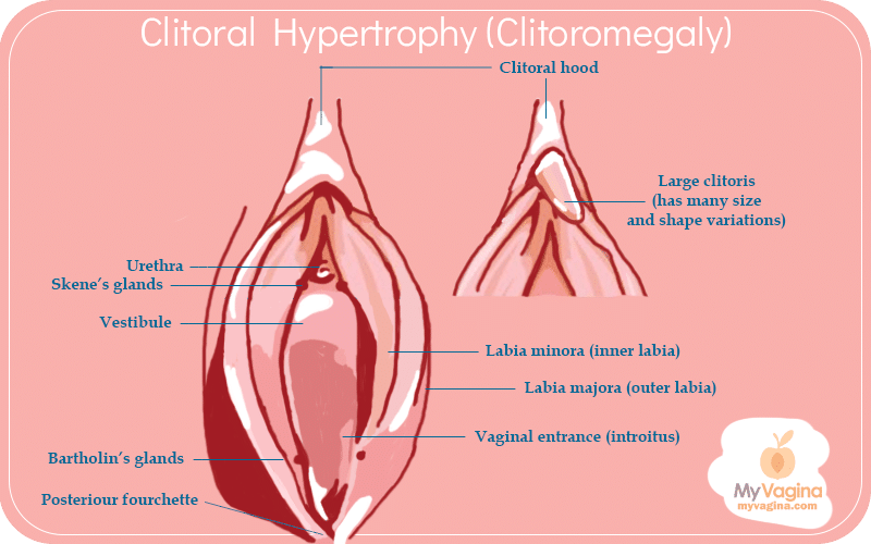 Largest Clitoris In The World the counter