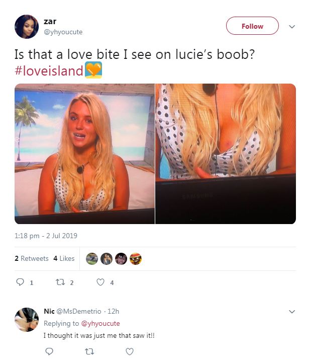dinky roy recommends love bite on breast pic
