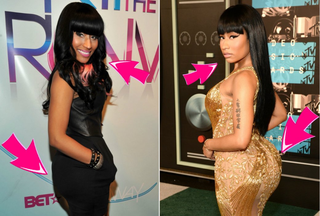 dodi priambodo recommends Nicki Minaj Antes Y Despues