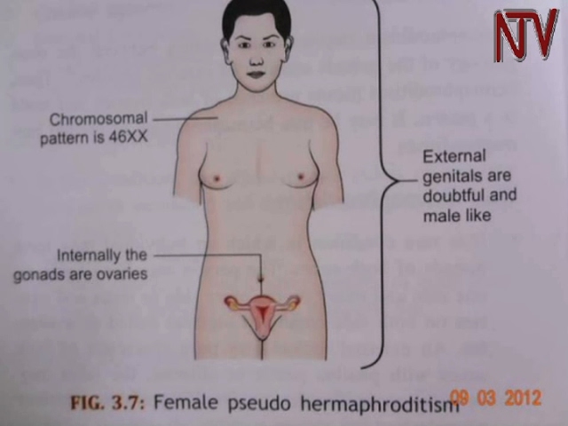 Pics Of Intersex Organs her ass