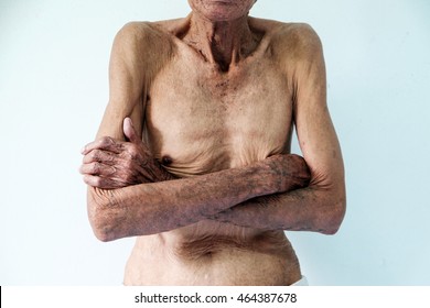 darren borg recommends skinny naked old men pic