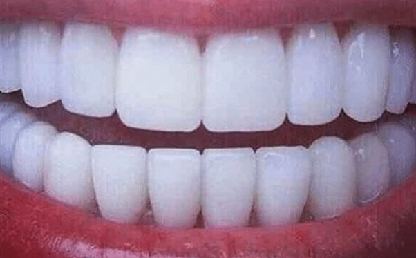 The Whitest Teeth Ever garden ho