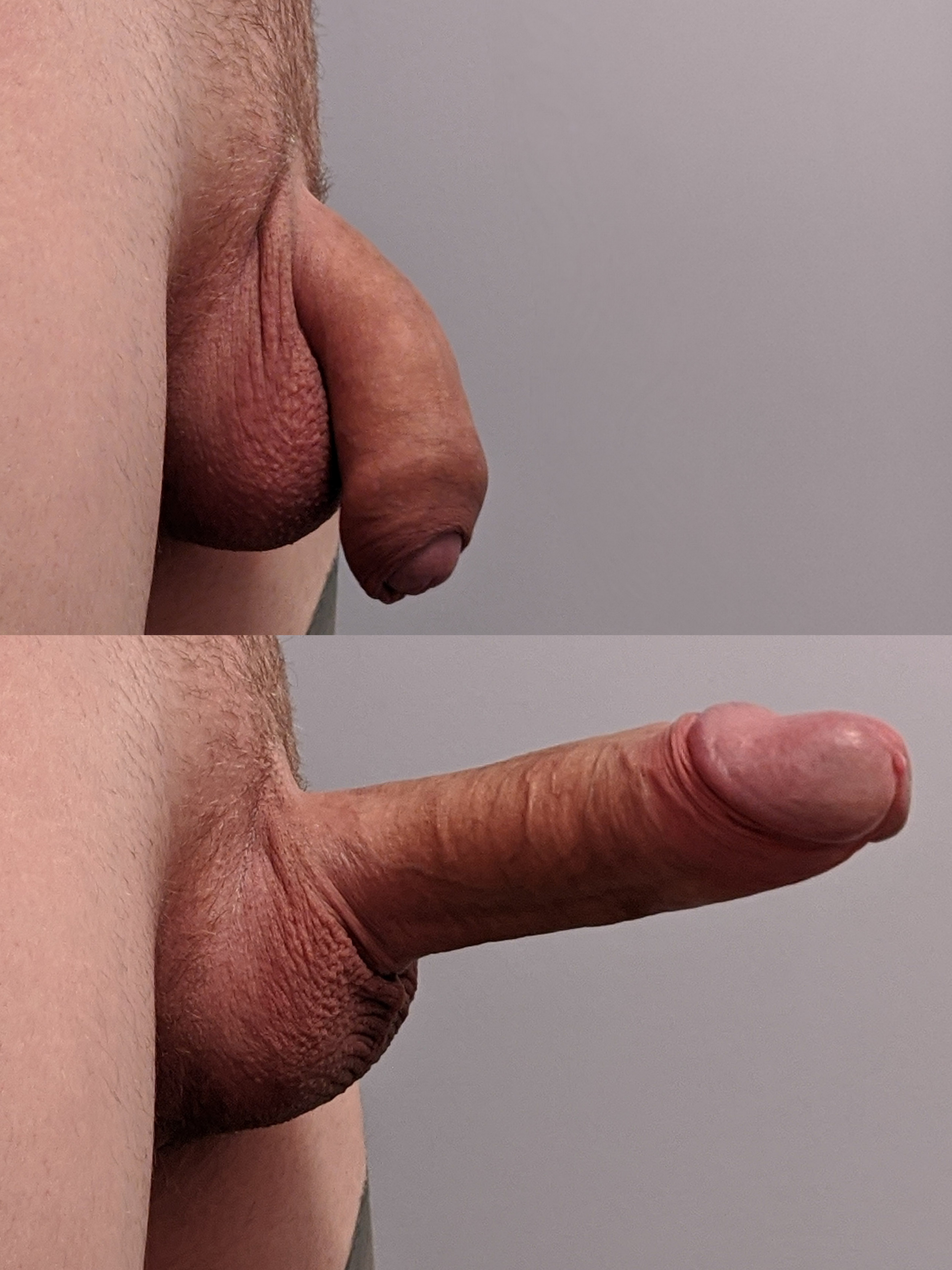 aan prima add photo uncircumcised penis photo