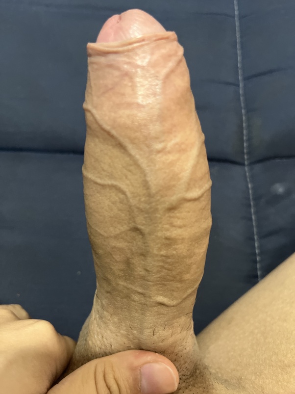 daniel eisen recommends uncircumcised penis pics pic