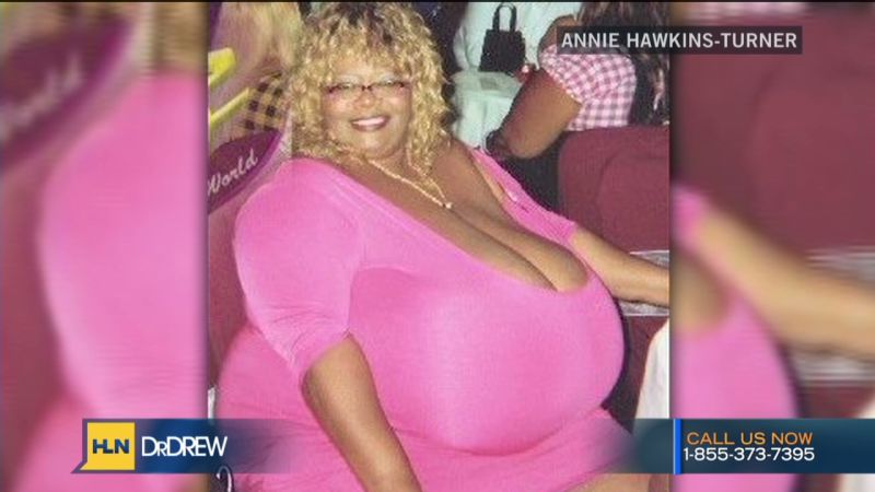 dorothy ann reynolds recommends what are the biggest tits in the world pic