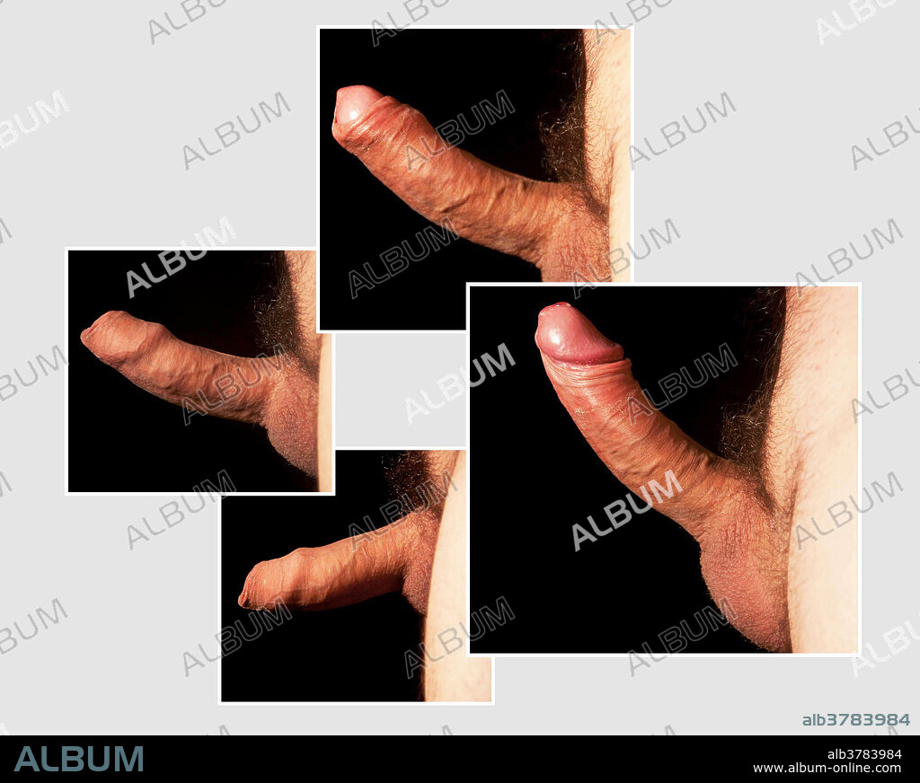 bryan saindon recommends what does an erect uncircumcised look like pic
