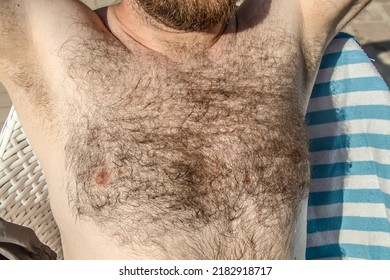 women with hairy breast