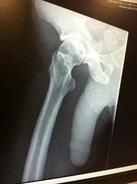 xray with big penis