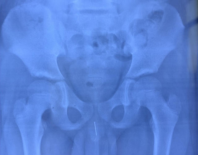 cynthia do share xray with big penis photos